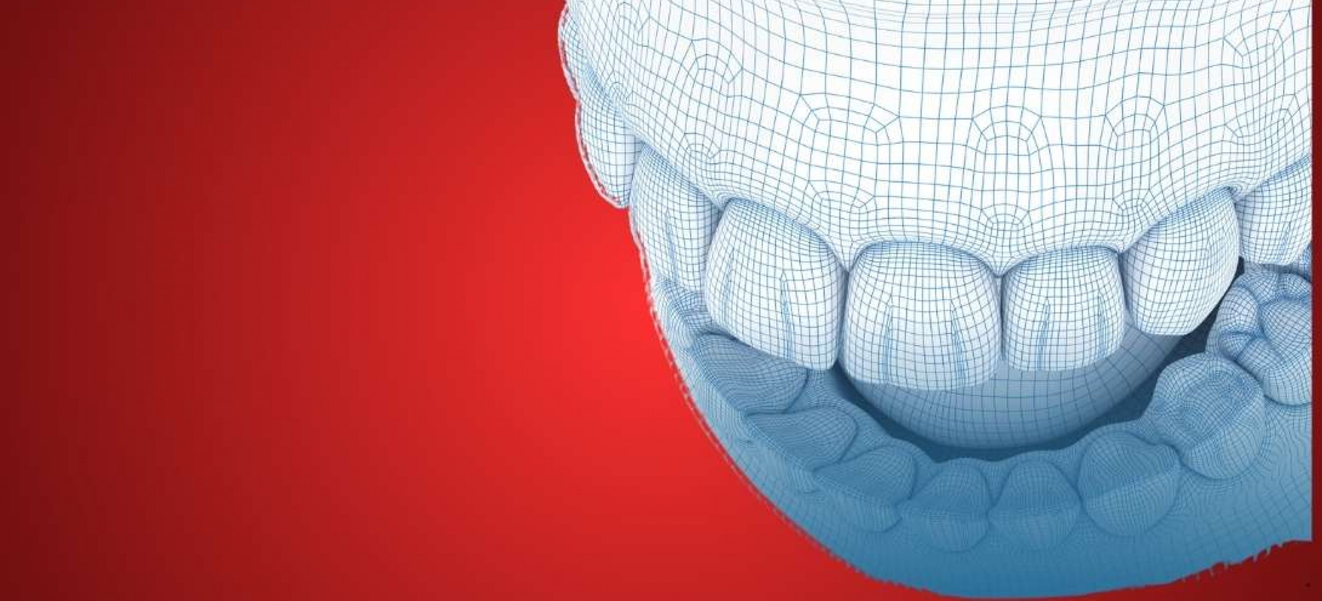 Smriirkers CAD Dental Design Services from India to Worlwide