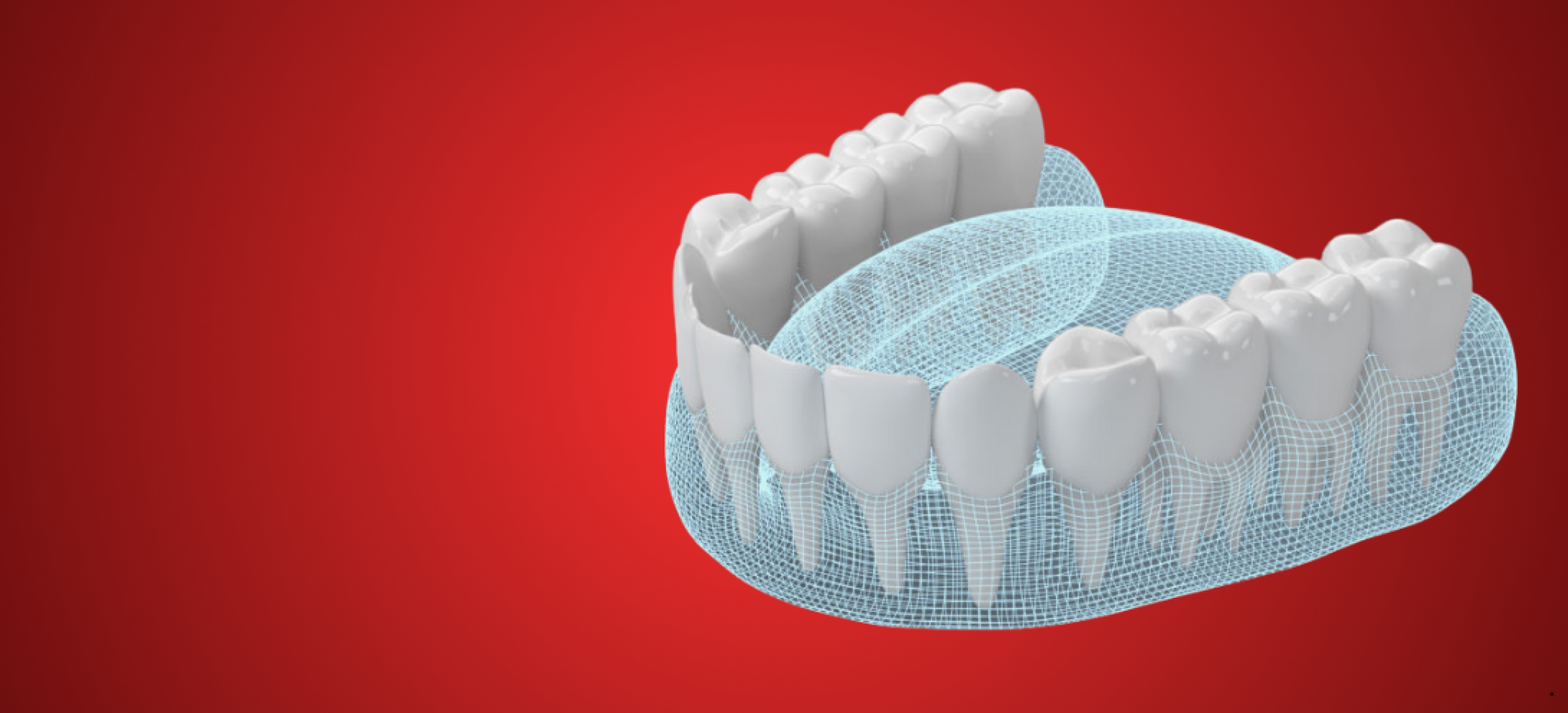 Smriirkers CAD Dental Design Services from India to Worlwide
