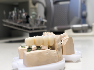 Unlocking Benefits and Efficiency to Outsource Dental CAD Design from India