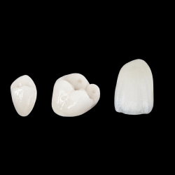 Ambria Full Contour Glass Ceramic Crowns