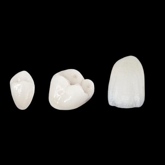 Ambria Layered Lithium Disilicate Crowns Ambria Layered Lithium Disilicate Crowns